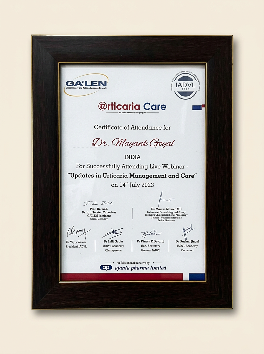 Urticaria Care — Updates in Management & Care